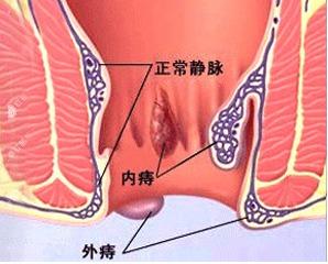 吃小乳瓜对痔疮好吗视频,视频揭秘食疗新选择